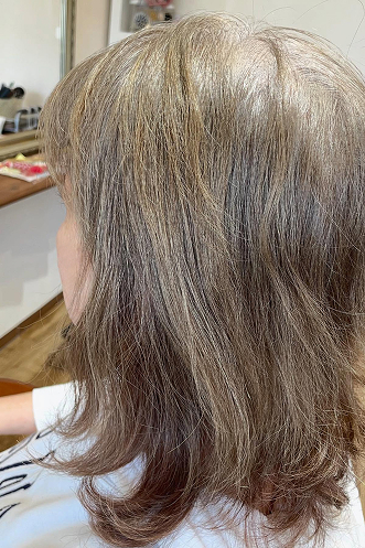 Case 07ビフォアー